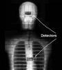 The differences don't show up in x-rays, must be a mental thing.